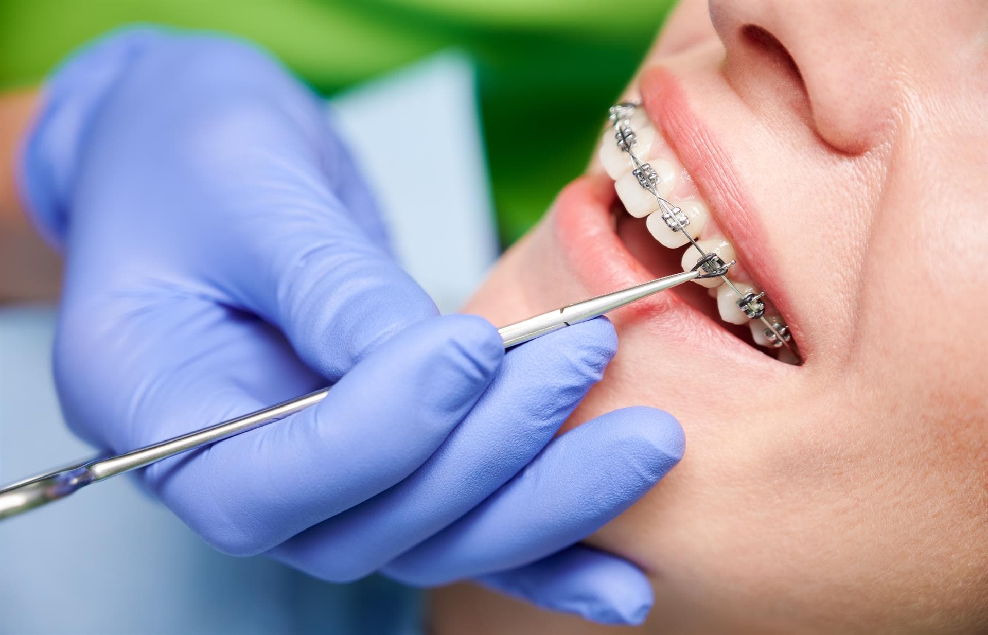 ¿Qué es una ortodoncia?