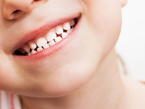 ¿A qué edad debe ir mi hijo al dentista por primera vez?