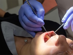 Alimentación tras una cirugía oral: dieta blanda, fría y sin pajitas