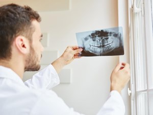 ¿Cómo funciona la radiología digital en odontología? 