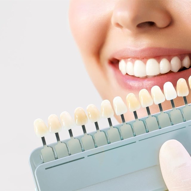 ¿Cómo la estética dental puede corregir asimetrías?