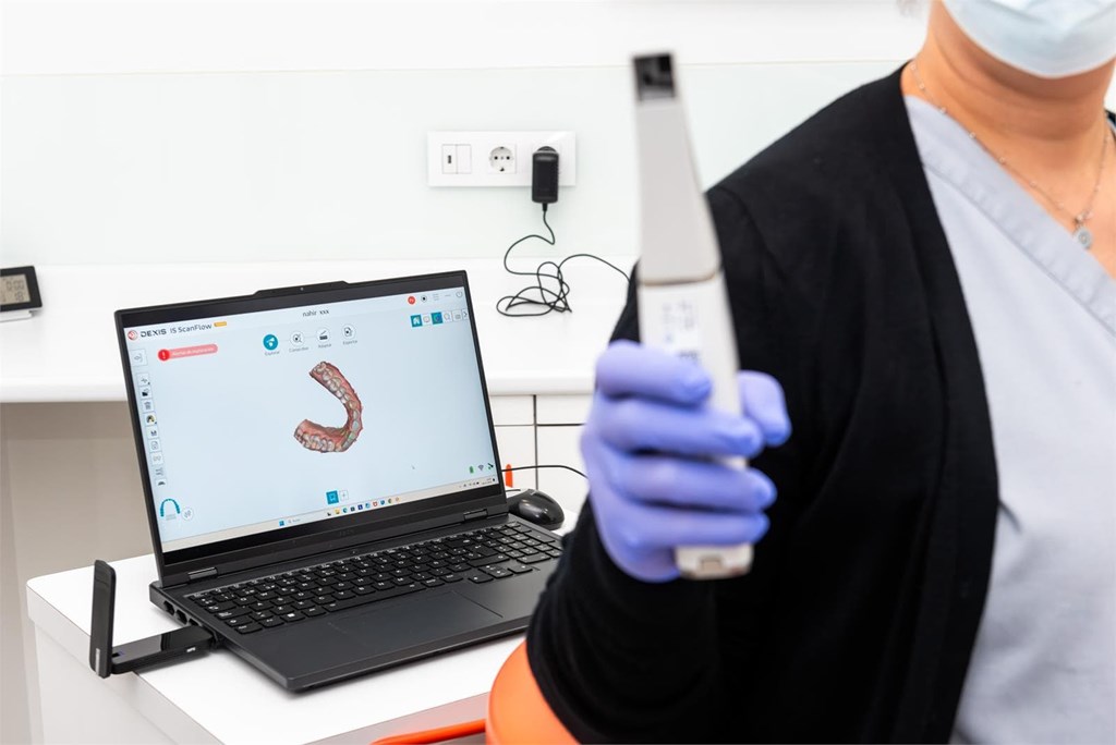 ¿Cuánto tiempo dura todo el proceso de un implante dental, desde la cirugía hasta la corona?