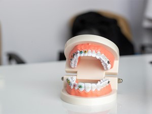 ¿Demasiado pronto para poner brackets?