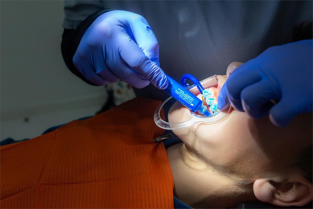 Diferencias entre un empaste y una endodoncia
