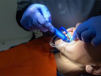 Diferencias entre un empaste y una endodoncia