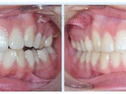 H-central-670x300