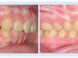 H-derecha-3-1024x354