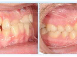 H-Derecha-min-1-1024x354