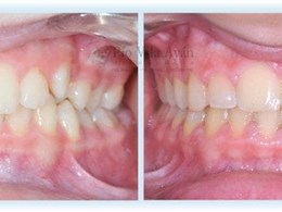 H-frontal-2-670x300