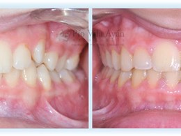 H-frontal-2-scaled