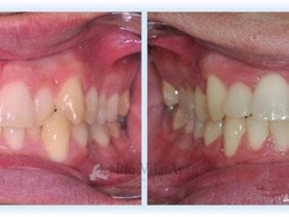 H-frontal-5-1024x354