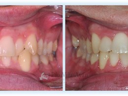 H-frontal-5-scaled