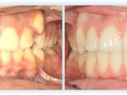H-frontal-6-1024x354