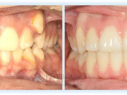 H-frontal-6-scaled