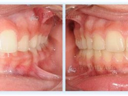 H-Frontal-min--670x300