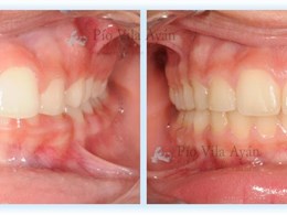 H-Frontal-min--scaled