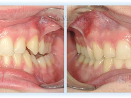 H-frontal-scaled