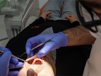 ¿Hay una edad límite para ponerse implantes dentales?