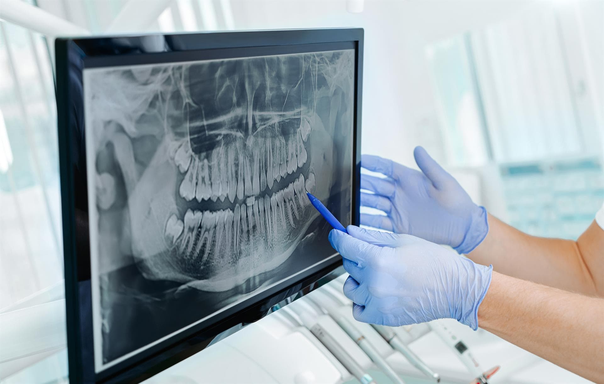 Cirugía oral e implantes