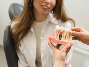 Implantes dentales o prótesis removibles: ¿cuál es la mejor opción para ti?